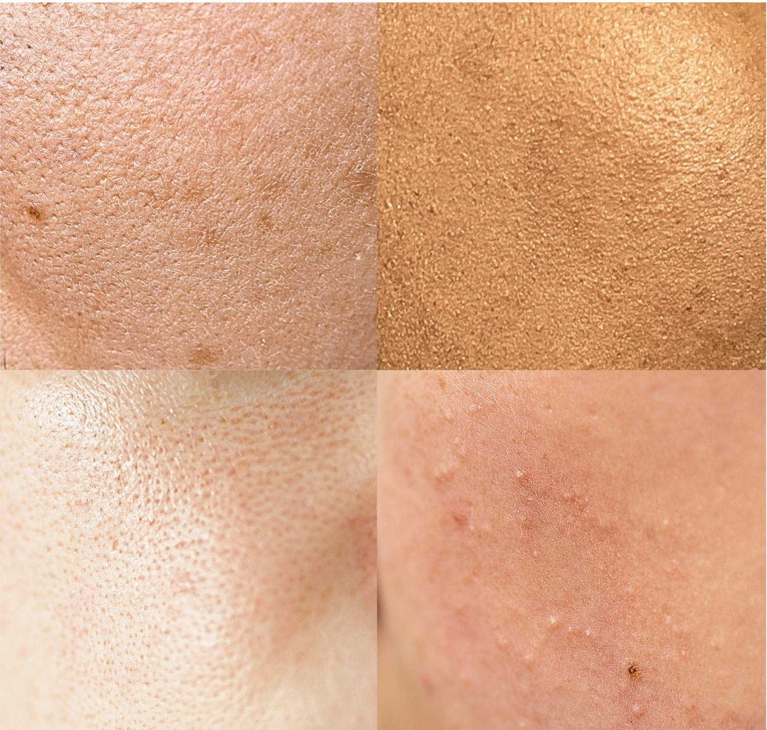 When did skin get so textured?