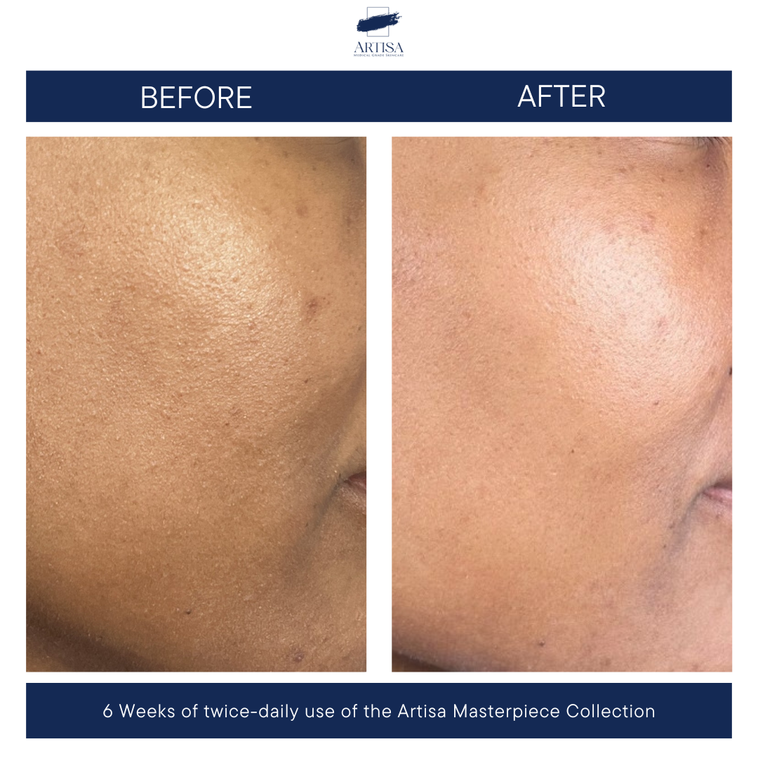 The Masterpiece Collection