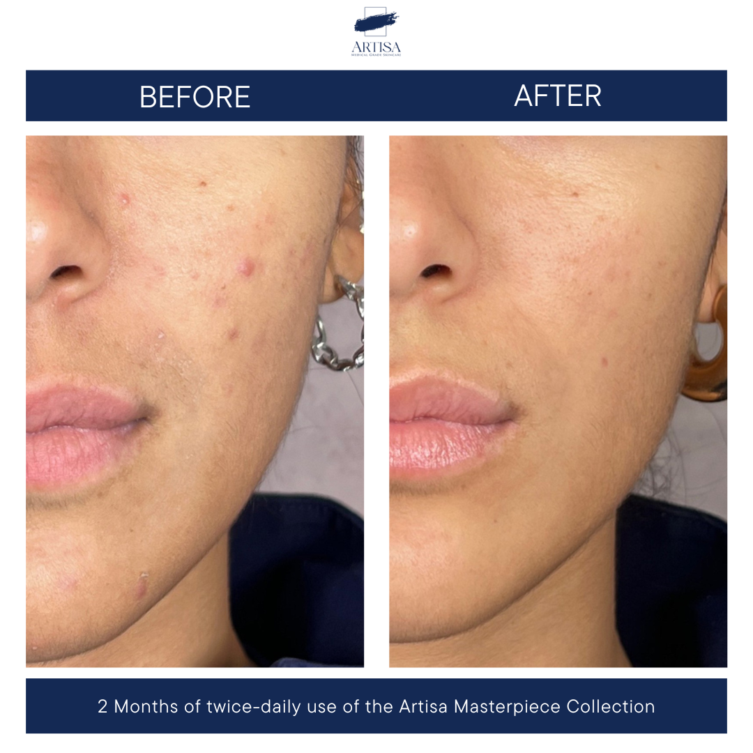 The Masterpiece Collection