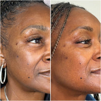 Real customer B/A — 12 weeks