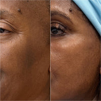 Real customer B/A — 12 weeks